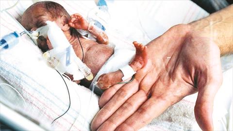 إليزابيث الطفلة "المعجزة"